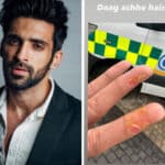Arjit Taneja sprains his fingers while performing stunts; the actor posts an image on social media