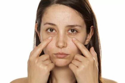 Grasping Under-Eye Dark Circles: Causes and Thorough Treatment