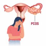 Understanding the Link Between PCOS and Stress