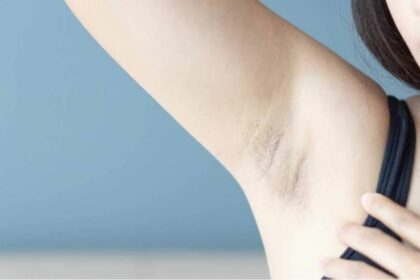 Natural Solutions for Lighting up Dark Underarms