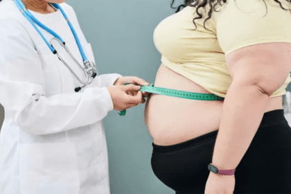 Bariatric Surgery could be a good option for obese patientse’
